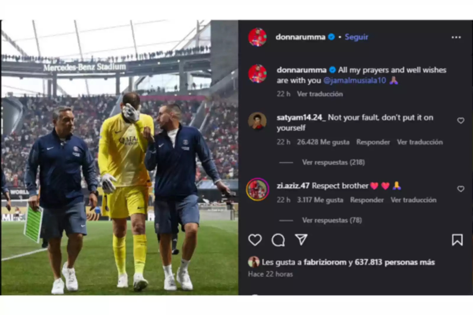 Neuer's harsh criticism of Donnarumma after Musiala's chilling injury