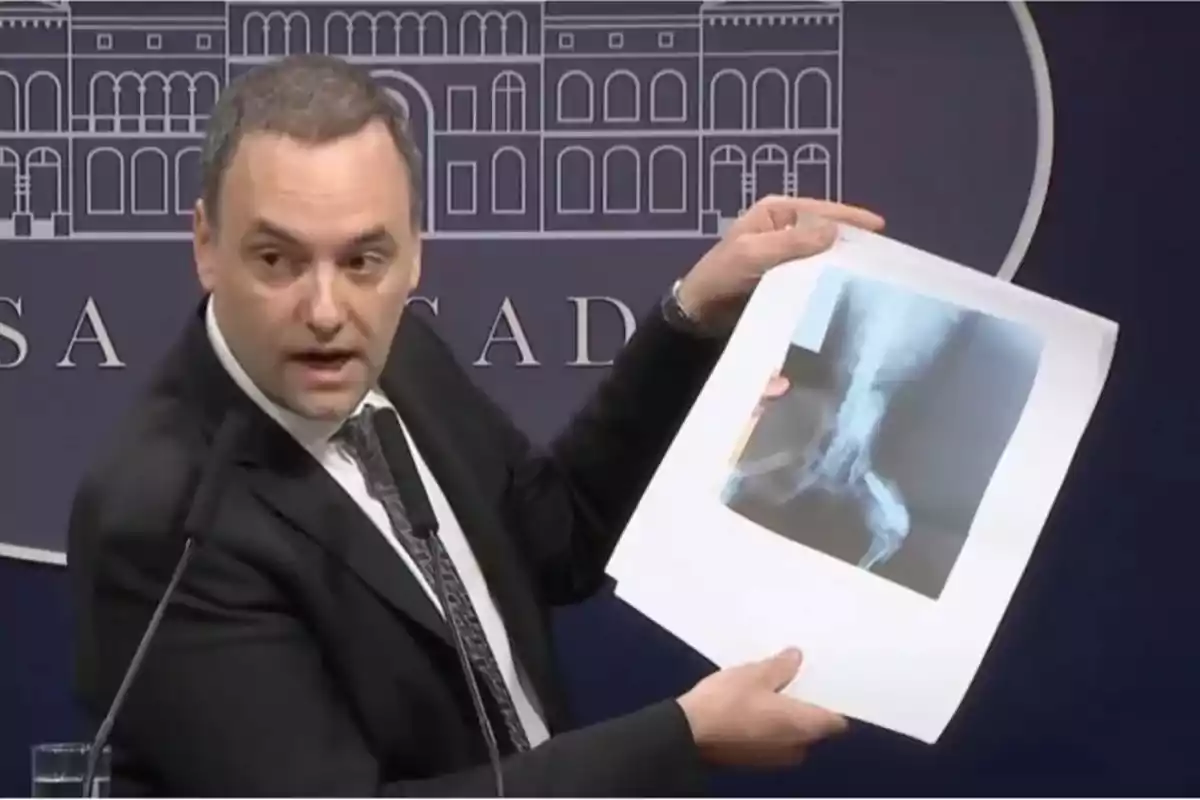 Hombre de traje mostrando una radiografía impresa durante una conferencia de prensa Hombre de traje mostrando una radiografía impresa durante una conferencia de prensa