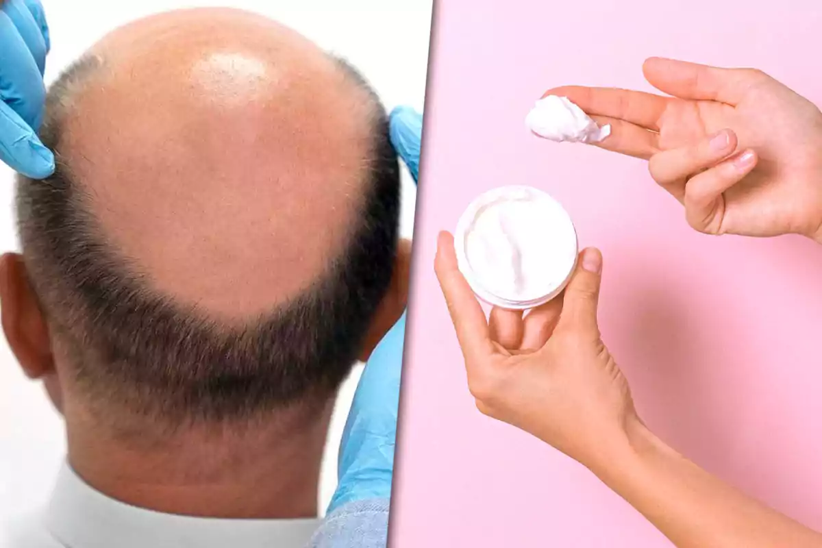 Un hombre calvo visto desde atrás y unas manos sosteniendo un frasco de crema con fondo rosa