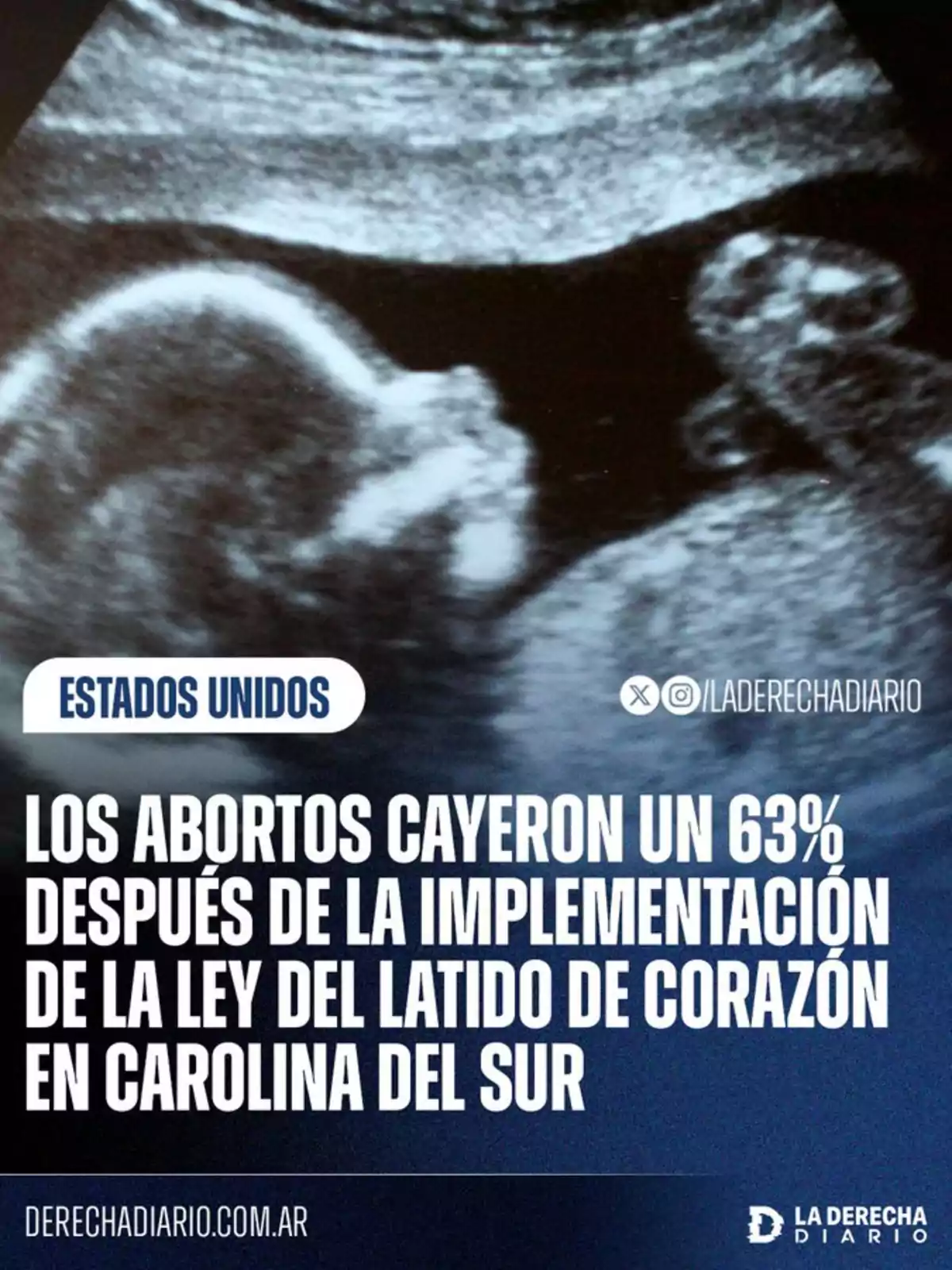 Ultrasound of a fetus accompanied by text reporting a decrease in abortions in South Carolina following the implementation of a heartbeat-related law Ultrasound of a fetus accompanied by text reporting a decrease in abortions in South Carolina following the implementation of a heartbeat-related law