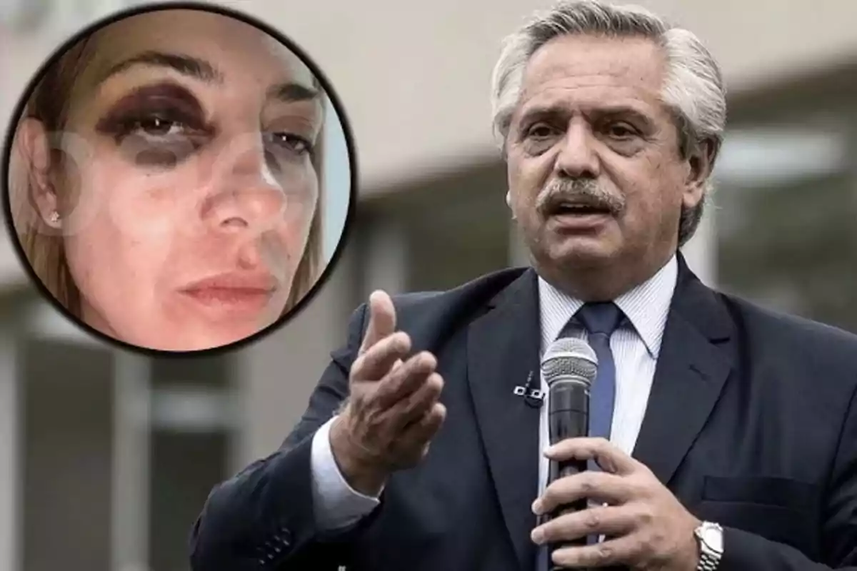 A gray-haired man with a mustache holds a microphone while gesturing with his hand; in the upper left corner, the face of a woman with a visible bruise around her left eye appears. A gray-haired man with a mustache holds a microphone while gesturing with his hand; in the upper left corner, the face of a woman with a visible bruise around her left eye appears.