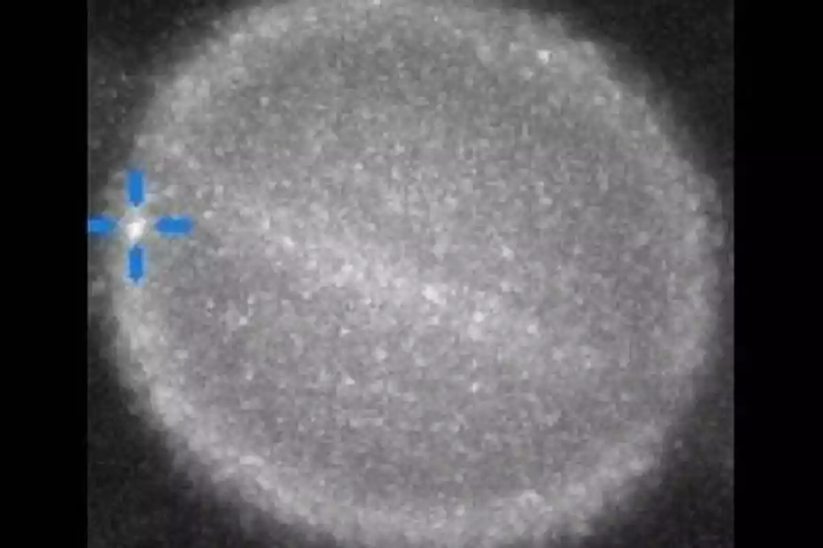 Imagen en blanco y negro de una célula vista al microscopio con una cruz azul en el lado izquierdo Imagen en blanco y negro de una célula vista al microscopio con una cruz azul en el lado izquierdo