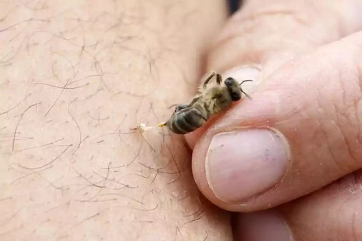 A bee is stinging a person's skin and its stinger remains embedded while a hand holds it. A bee is stinging a person's skin and its stinger remains embedded while a hand holds it.