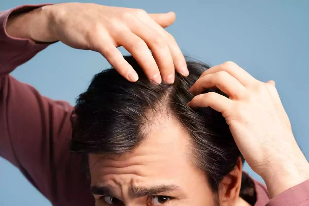 Hombre revisando su cuero cabelludo con las manos mostrando signos de pérdida de cabello Hombre revisando su cuero cabelludo con las manos mostrando signos de pérdida de cabello