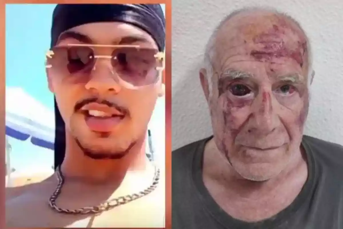 Dos hombres uno joven con gafas de sol y cadena dorada y otro mayor con el rostro golpeado y moretones