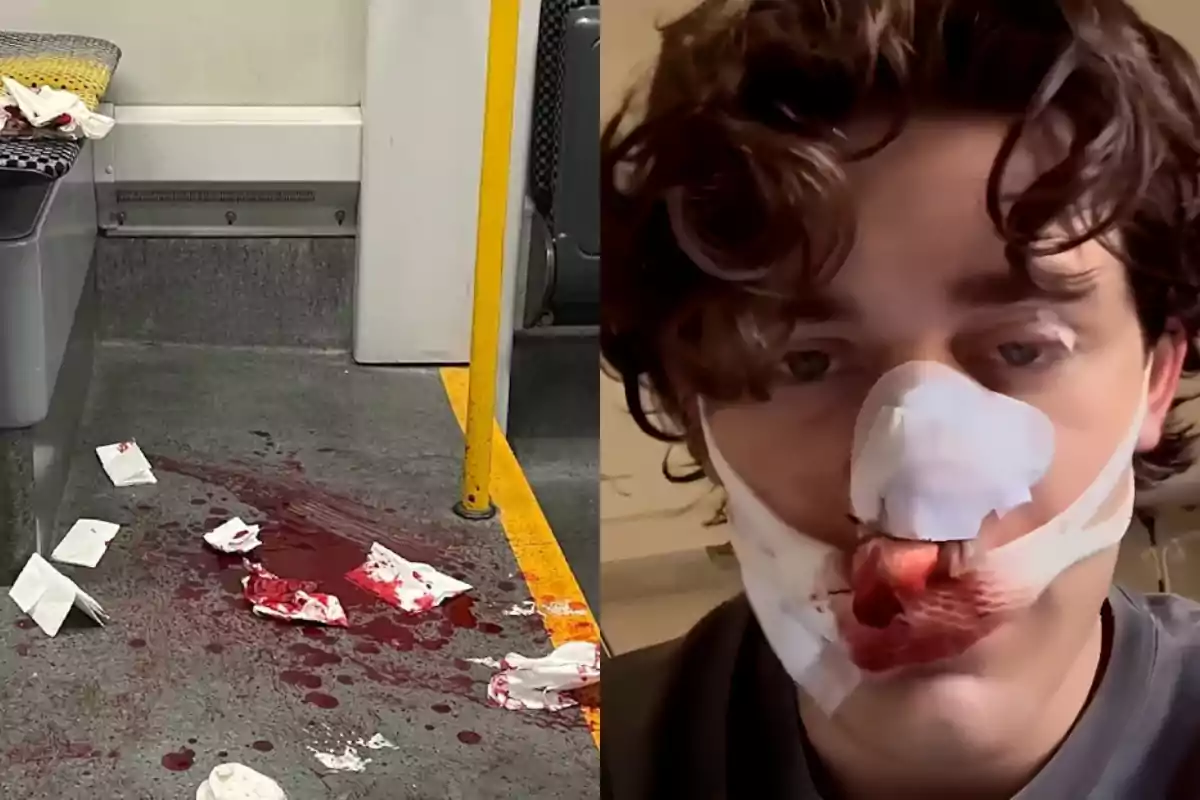 A train car with blood stains and napkins on the floor next to a young man with a bandaged nose and a bloody lip