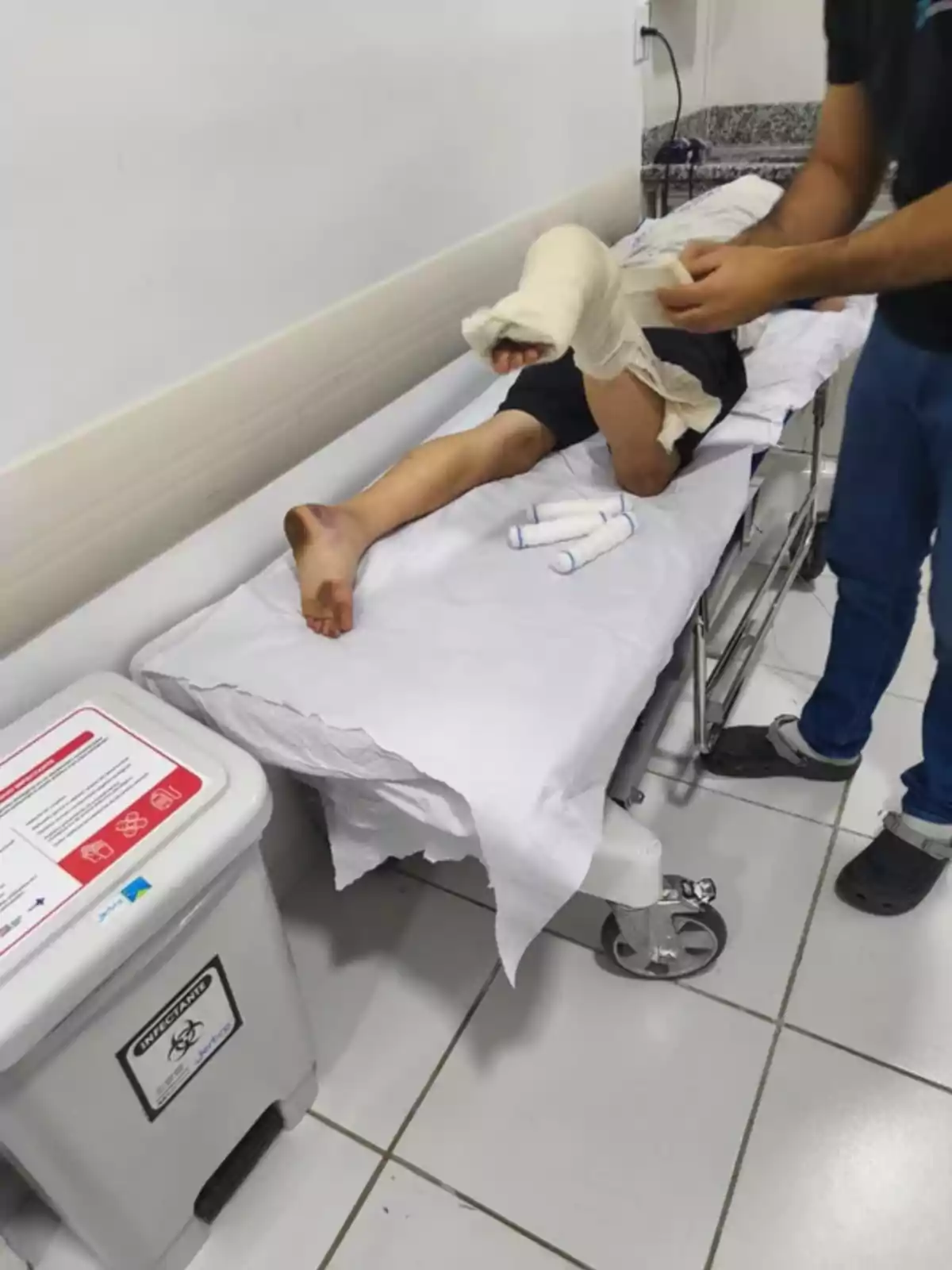 Persona acostada en una camilla de hospital con una pierna enyesada mientras un profesional de la salud termina de colocar el vendaje Persona acostada en una camilla de hospital con una pierna enyesada mientras un profesional de la salud termina de colocar el vendaje