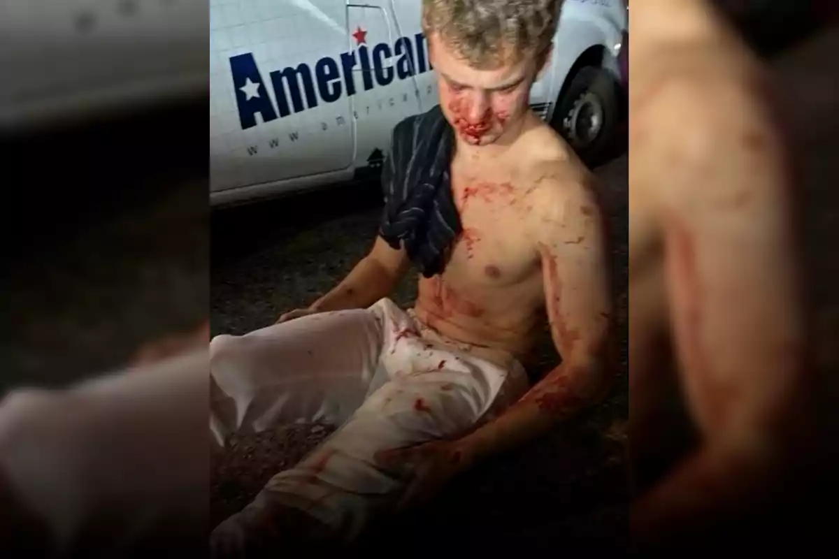 Shirtless young man with blood stains on his face and body sitting on the ground in front of a white pickup truck