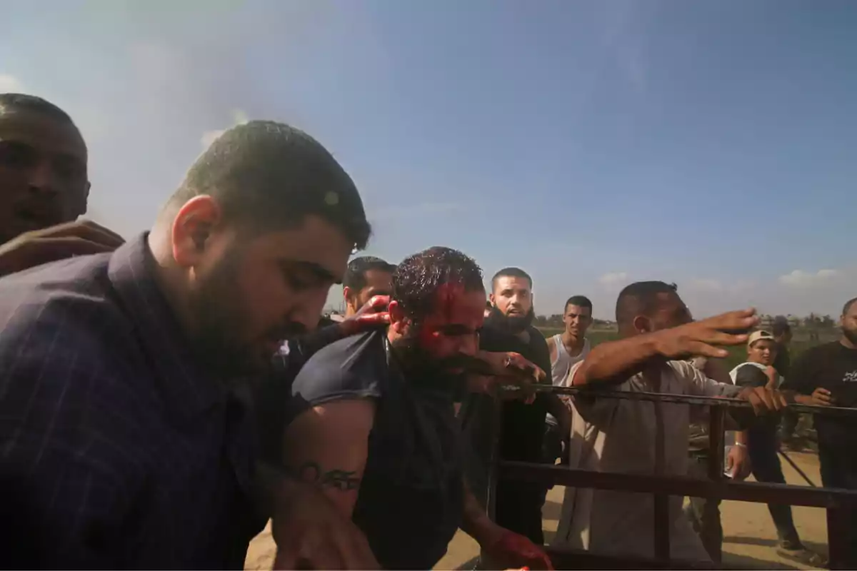 A group of men helps an injured person with blood on their head while others watch with concern under a clear sky. A group of men helps an injured person with blood on their head while others watch with concern under a clear sky.