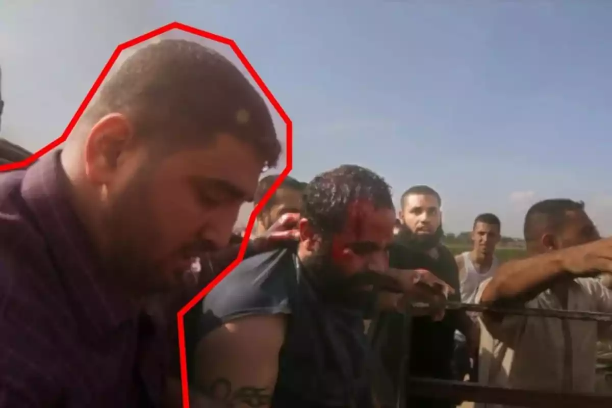 A group of men surrounds an injured person with blood on their head under a clear sky.