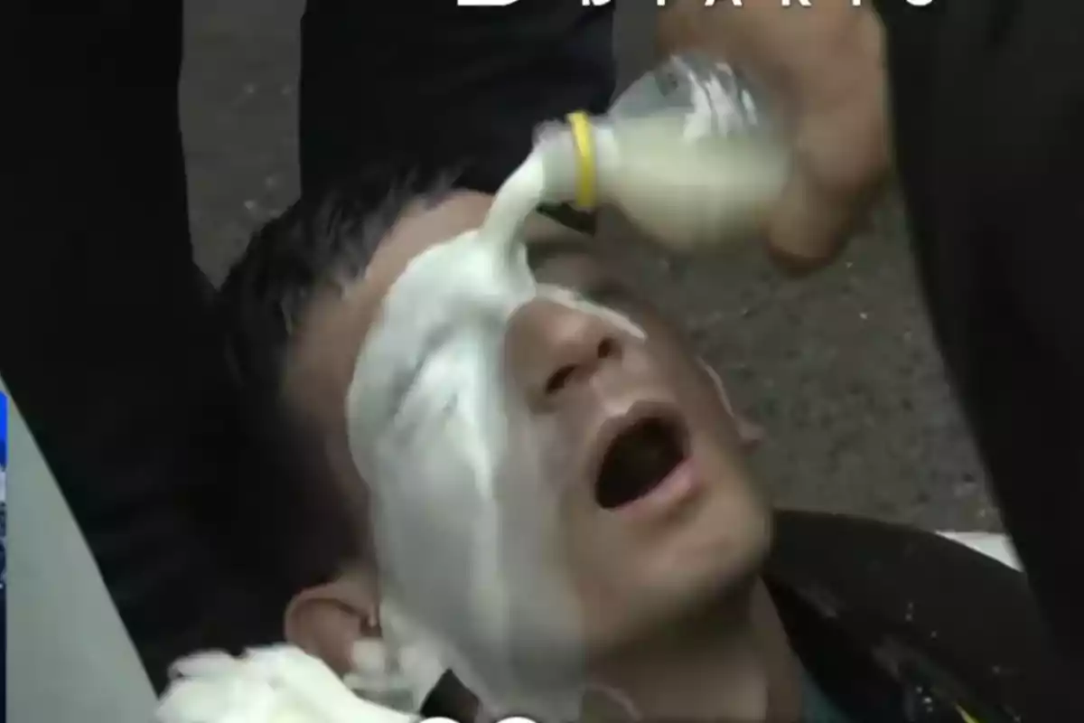 Person lying down with their eyes closed while another person pours white liquid on their face using a bottle
