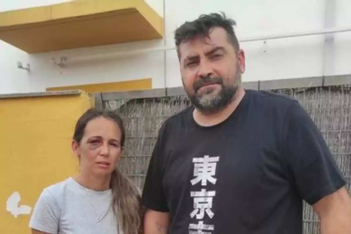 Una mujer con un ojo morado y un hombre de barba posan juntos al aire libre frente a una pared amarilla y una cerca