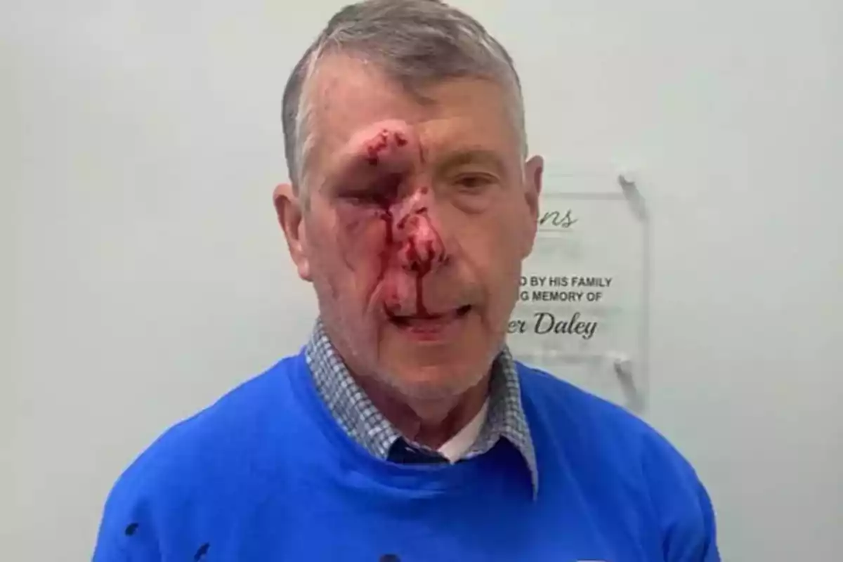 Hombre mayor con heridas sangrantes en el rostro y camiseta azul frente a una pared blanca