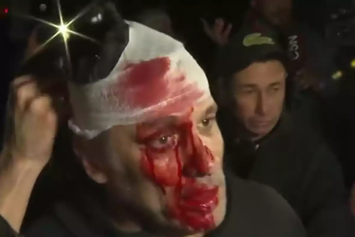 Man with a bandaged head and blood-covered face in the middle of a crowd