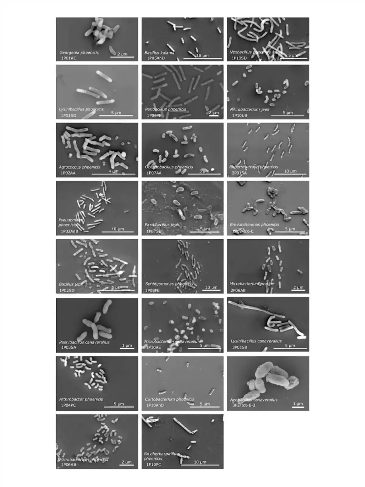 La imagen muestra una serie de microfotografías de diferentes bacterias, cada una etiquetada con su nombre científico y una escala de medida en micrómetros, lo que permite observar la diversidad de formas y tamaños de estos microorganismos. La imagen muestra una serie de microfotografías de diferentes bacterias, cada una etiquetada con su nombre científico y una escala de medida en micrómetros, lo que permite observar la diversidad de formas y tamaños de estos microorganismos.
