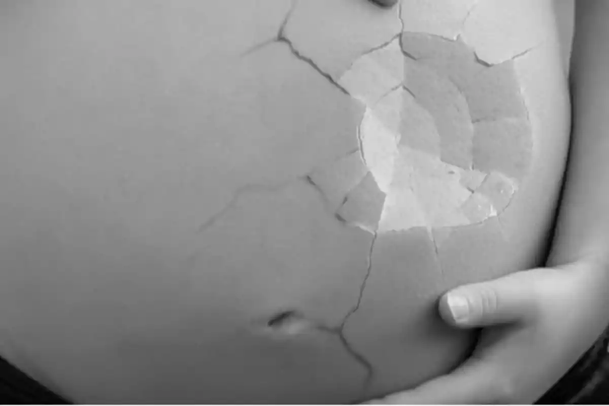 Vientre de mujer embarazada con efecto visual de piel agrietada y una mano apoyada.
