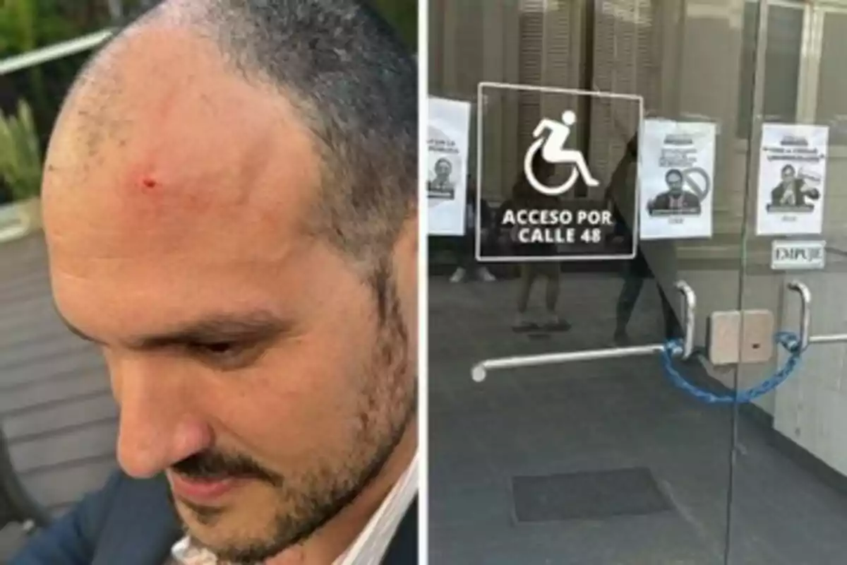 Un hombre con una herida en la frente y una puerta de vidrio con un cartel de acceso para personas con discapacidad.