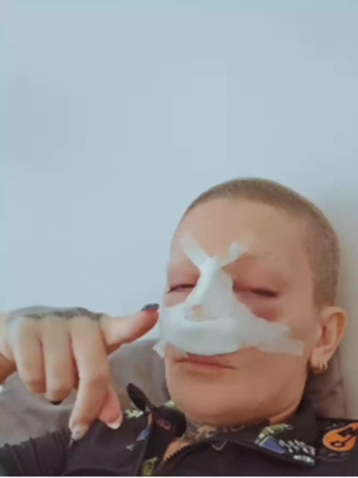 Shaved-headed person lying down, with bandages and adhesive tape on their nose and face, pointing toward the camera with their hand Shaved-headed person lying down, with bandages and adhesive tape on their nose and face, pointing toward the camera with their hand