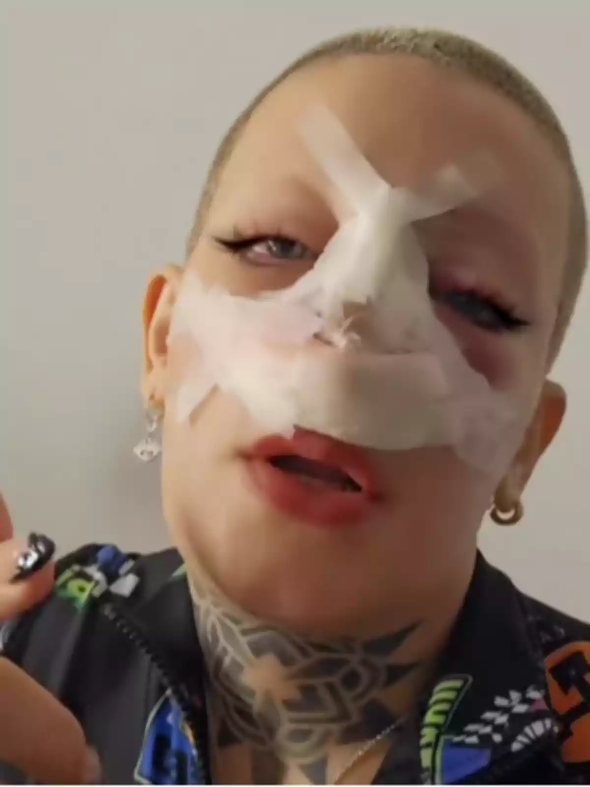 Person with a bandaged face, visible makeup, short hair, and a tattoo on the neck Person with a bandaged face, visible makeup, short hair, and a tattoo on the neck