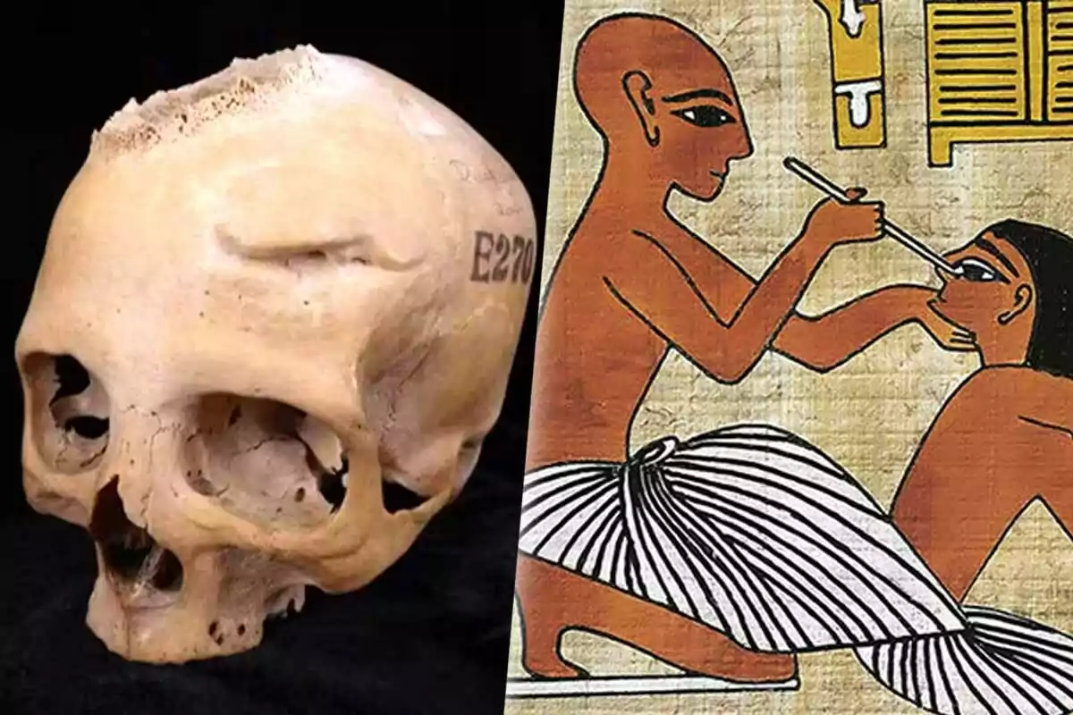 Un cráneo humano con una marca alfanumérica junto a una ilustración del antiguo Egipto que muestra a una persona realizando un procedimiento médico en otra.