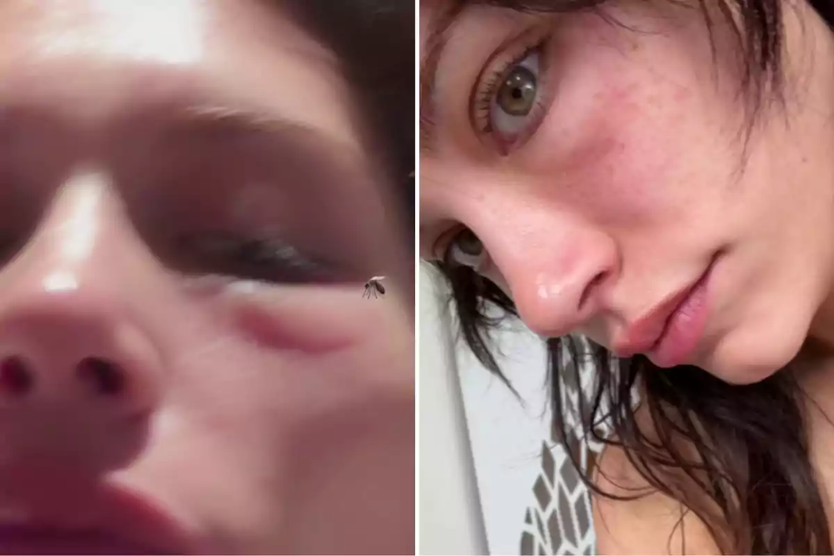Una persona con marcas en el rostro en dos imágenes diferentes. Una persona con marcas en el rostro en dos imágenes diferentes.