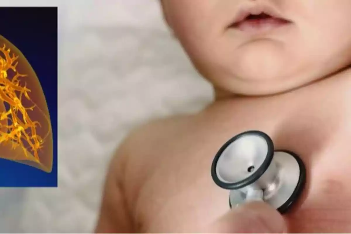 A baby being examined with a stethoscope on the chest next to an image of a lung with a graphic design.